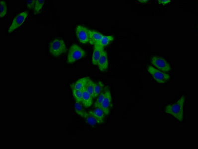 MUC20 Antibody - Immunofluorescence staining of HepG2 cells at a dilution of 1:200, counter-stained with DAPI. The cells were fixed in 4% formaldehyde, permeabilized using 0.2% Triton X-100 and blocked in 10% normal Goat Serum. The cells were then incubated with the antibody overnight at 4 °C.The secondary antibody was Alexa Fluor 488-congugated AffiniPure Goat Anti-Rabbit IgG (H+L) .