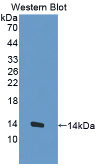 MUC3B Antibody - Western blot of MUC3B antibody.