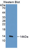 MUC3B Antibody - Western blot of MUC3B antibody.