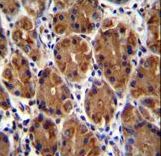 MUC3B Antibody - MUC3B Antibody (C-term E881) immunohistochemistry of formalin-fixed and paraffin-embedded human stomach tissue followed by peroxidase-conjugated secondary antibody and DAB staining.