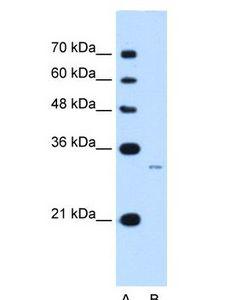 MUC3B Antibody - MUC3B antibody Western Blot of Jurkat cell lysate.  This image was taken for the unconjugated form of this product. Other forms have not been tested.