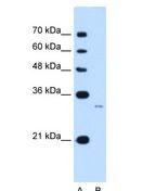 MUC3B Antibody - MUC3B antibody Western Blot of Jurkat cell lysate.  This image was taken for the unconjugated form of this product. Other forms have not been tested.