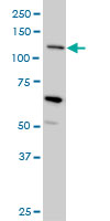 MUC4 Antibody - MUC4 monoclonal antibody (M07), clone 5B12 Western blot of MUC4 expression in HeLa.