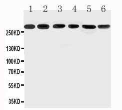 MUC5AC Antibody - WB of MUC5AC antibody. All lanes: Anti-MUC5AC at 0.5ug/ml. Lane 1: SGC Whole Cell Lysate at 40ug. Lane 2: HELA Whole Cell Lysate at 40ug. Lane 3: COLO320 Whole Cell Lysate at 40ug. Lane 4: SW620 Whole Cell Lysate at 40ug. Lane 5: MCF-7 Whole Cell Lysate at 40ug. Lane 6: PANC Whole Cell Lysate at 40ug. Predicted bind size: 527KD. Observed bind size: 300KD.