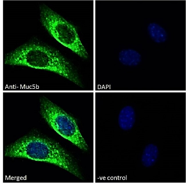 MUC5B Antibody - Goat Anti-Muc5b (mouse) Antibody Immunofluorescence analysis of paraformaldehyde fixed NIH3T3 cells, permeabilized with 0.15% Triton. Primary incubation 1hr (10ug/ml) followed by Alexa Fluor 488 secondary antibody (2ug/ml), showing vesicle staining. The nuclear stain is DAPI (blue). Negative control: Unimmunized goat IgG (10ug/ml) followed by Alexa Fluor 488 secondary antibody (2ug/ml).