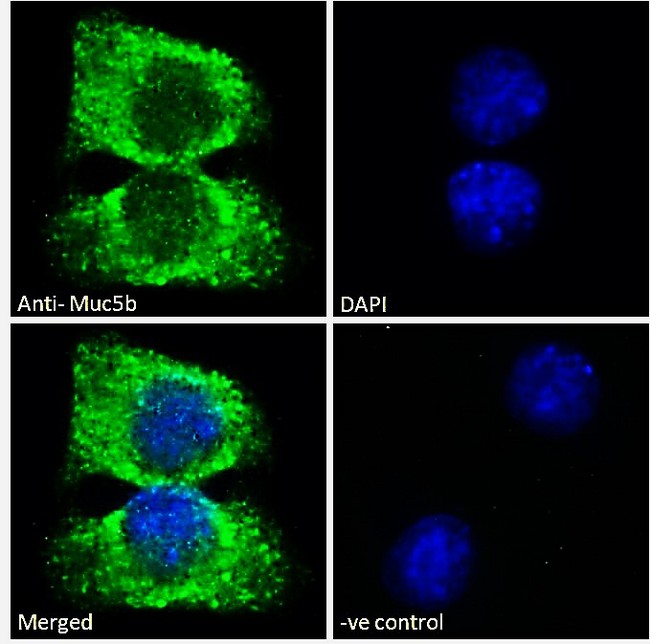 MUC5B Antibody - Goat Anti-Muc5b (mouse) Antibody-Immunofluorescence analysis of paraformaldehyde fixed A549 cells, permeabilized with 0.15% Triton. Primary incubation 1hr (10ug/ml) followed by Alexa Fluor 488 secondary antibody (2ug/ml), showing vesicle staining. The nuclear stain is DAPI (blue). Negative control: Unimmunized goat IgG (10ug/ml) followed by Alexa Fluor 488 secondary antibody (2ug/ml).