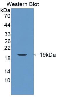 MUC5B Antibody - Western blot of MUC5B antibody.