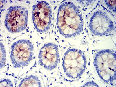 MUC5B Antibody - Immunohistochemical analysis of paraffin-embedded rectum tissues using MUC5B mouse mAb with DAB staining.