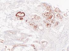 MUC6 / MUC-6 Antibody - Gastric Adenocarcinoma