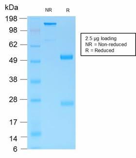 MUC6 / MUC-6 Antibody - SDS-PAGE Analysis Purified MUC6 Rabbit Recombinant Monoclonal Antibody (MUC6/1553R). Confirmation of Purity and Integrity of Antibody.