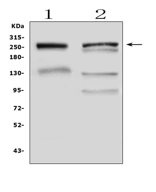 MUC6 / MUC-6 Antibody - Western blot analysis of Gastric Mucin using anti-Gastric Mucin antibody. Electrophoresis was performed on a 5-20% SDS-PAGE gel at 70V (Stacking gel) / 90V (Resolving gel) for 2-3 hours. The sample well of each lane was loaded with 50ug of sample under reducing conditions. Lane 1: mouse stomach tissue lysates, Lane 2: human SGC-7901 whole cell lysates. After Electrophoresis, proteins were transferred to a Nitrocellulose membrane at 150mA for 50-90 minutes. Blocked the membrane with 5% Non-fat Milk/ TBS for 1.5 hour at RT. The membrane was incubated with rabbit anti-Gastric Mucin antigen affinity purified polyclonal antibody at 0.5 ?g/mL overnight at 4?C, then washed with TBS-0.1% Tween 3 times with 5 minutes each and probed with a goat anti-rabbit IgG-HRP secondary antibody at a dilution of 1:10000 for 1.5 hour at RT. The signal is developed using an Enhanced Chemiluminescent detection (ECL) kit with Tanon 5200 system. A specific band was detected for Gastric Mucin at approximately 257KD. The expected band size for Gastric Mucin is at 257KD.