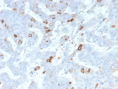 Mucin 2 / MUC2 Antibody - Formalin-fixed, paraffin-embedded human Colon stained with MUC2 Rabbit Recombinant Monoclonal Antibody (MLP/2970R).