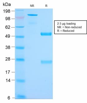 Mucin 2 / MUC2 Antibody - SDS-PAGE Analysis Purified MUC2 Rabbit Recombinant Monoclonal Antibody (MLP/2970R). Confirmation of Purity and Integrity of Antibody.