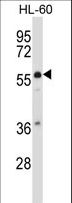 Mucolipin 3 / TRPML3 Antibody - MCOLN3 Antibody western blot of HL-60 cell line lysates (35 ug/lane). The MCOLN3 antibody detected the MCOLN3 protein (arrow).