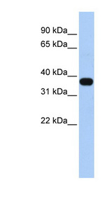 MUL1 / MULAN Antibody - MUL1 / C1orf166 antibody Western blot of Fetal Heart lysate. This image was taken for the unconjugated form of this product. Other forms have not been tested.