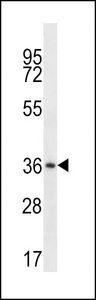 MUL1 / MULAN Antibody - MUL1 Antibody western blot of human placenta tissue lysates (35 ug/lane). The MUL1 antibody detected the MUL1 protein (arrow).