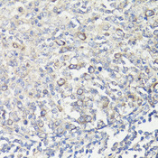 MUL1 / MULAN Antibody - Immunohistochemistry of paraffin-embedded human tonsil using MUL1 antibody at dilution of 1:100 (40x lens).