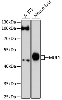 MUL1 / MULAN Antibody - Western blot analysis of extracts of various cell lines, using MUL1 antibody at 1:3000 dilution. The secondary antibody used was an HRP Goat Anti-Rabbit IgG (H+L) at 1:10000 dilution. Lysates were loaded 25ug per lane and 3% nonfat dry milk in TBST was used for blocking. An ECL Kit was used for detection and the exposure time was 90s.