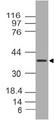 MUL1 / MULAN Antibody - Fig-1: Western blot analysis of MUL1. Anti-MUL1 antibody was tested at 4 µg/ml on human SKM lysate.