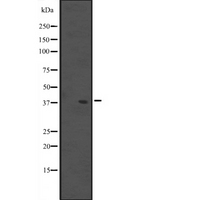 MUL1 / MULAN Antibody - Western blot analysis of MUL1 expression in A431 whole cells lysate. The lane on the left is treated with the antigen-specific peptide.