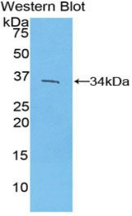 MUM1 Antibody - Western blot of recombinant MUM1.  This image was taken for the unconjugated form of this product. Other forms have not been tested.