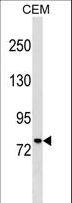 MUM1 Antibody - MUM1 Antibody western blot of CEM cell line lysates (35 ug/lane). The MUM1 antibody detected the MUM1 protein (arrow).