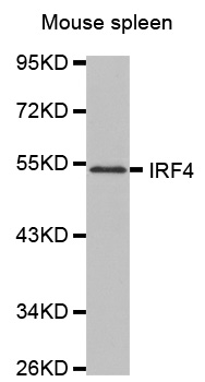 MUM1 Antibody - Western blot analysis of extracts of Mouse spleen.