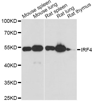 MUM1 Antibody - Western blot analysis of extracts of various cell lines, using IRF4 antibody at 1:3000 dilution. The secondary antibody used was an HRP Goat Anti-Rabbit IgG (H+L) at 1:10000 dilution. Lysates were loaded 25ug per lane and 3% nonfat dry milk in TBST was used for blocking. An ECL Kit was used for detection and the exposure time was 30s.