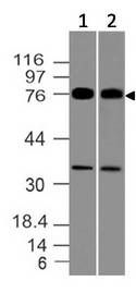 MUM1 Antibody - Fig-1: Expression analysis of MUM1. Anti-MUM1 antibody was used at 1 µg/ml on (1) Jurkat and (2) Ramos lysates.
