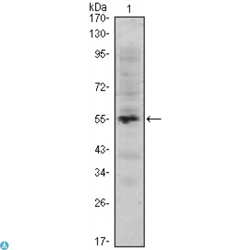 MUM1 Antibody - Western Blot (WB) analysis using MUM1 Monoclonal Antibody against recombinant fragment of human MUM1.