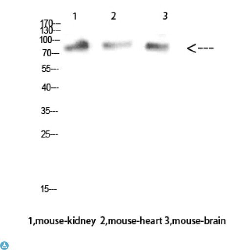 MUM1 Antibody - Western Blot (WB) analysis of Mouse Kidney Mouse Heart Mouse Brain cells using MUM1 Polyclonal Antibody diluted at 1:1000.