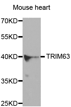 MURF1 / IRF Antibody - Western blot analysis of extracts of mouse heart cells.
