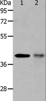 MURF1 / IRF Antibody - Western blot analysis of NIH/3T3 cell and human fetal muscle tissue, using TRIM63 Polyclonal Antibody at dilution of 1:1200.