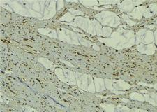 MURF1 / IRF Antibody - 1:100 staining mouse muscle tissue by IHC-P. The sample was formaldehyde fixed and a heat mediated antigen retrieval step in citrate buffer was performed. The sample was then blocked and incubated with the antibody for 1.5 hours at 22°C. An HRP conjugated goat anti-rabbit antibody was used as the secondary.