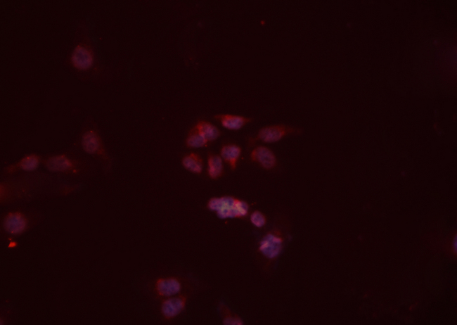 MURF1 / IRF Antibody - Staining HeLa cells by IF/ICC. The samples were fixed with PFA and permeabilized in 0.1% Triton X-100, then blocked in 10% serum for 45 min at 25°C. The primary antibody was diluted at 1:200 and incubated with the sample for 1 hour at 37°C. An Alexa Fluor 594 conjugated goat anti-rabbit IgG (H+L) antibody, diluted at 1/600 was used as secondary antibody.