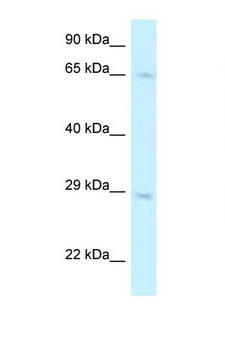 MUS81 Antibody - MUS81 antibody Western blot of A549 Cell lysate. Antibody concentration 1 ug/ml.  This image was taken for the unconjugated form of this product. Other forms have not been tested.