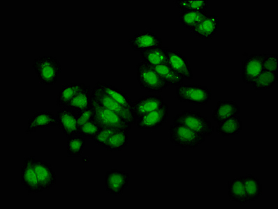 MUS81 Antibody - Immunofluorescence staining of HepG2 cells at a dilution of 1:100, counter-stained with DAPI. The cells were fixed in 4% formaldehyde, permeabilized using 0.2% Triton X-100 and blocked in 10% normal Goat Serum. The cells were then incubated with the antibody overnight at 4 °C.The secondary antibody was Alexa Fluor 488-congugated AffiniPure Goat Anti-Rabbit IgG (H+L) .