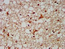 MUS81 Antibody - Immunohistochemistry image at a dilution of 1:300 and staining in paraffin-embedded human brain tissue performed on a Leica BondTM system. After dewaxing and hydration, antigen retrieval was mediated by high pressure in a citrate buffer (pH 6.0) . Section was blocked with 10% normal goat serum 30min at RT. Then primary antibody (1% BSA) was incubated at 4 °C overnight. The primary is detected by a biotinylated secondary antibody and visualized using an HRP conjugated SP system.