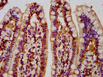 MUS81 Antibody - Immunohistochemistry image at a dilution of 1:300 and staining in paraffin-embedded human small intestine tissue performed on a Leica BondTM system. After dewaxing and hydration, antigen retrieval was mediated by high pressure in a citrate buffer (pH 6.0) . Section was blocked with 10% normal goat serum 30min at RT. Then primary antibody (1% BSA) was incubated at 4 °C overnight. The primary is detected by a biotinylated secondary antibody and visualized using an HRP conjugated SP system.