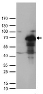 MUS81 Antibody - HEK293T cells were transfected with the pCMV6-ENTRY control. (Left lane) or pCMV6-ENTRY MUS81. (Right lane) cDNA for 48 hrs and lysed