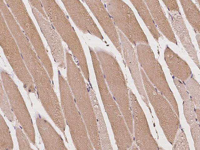 MUS81 Antibody - Immunochemical staining of human MUS81 in human skeletal muscle with rabbit polyclonal antibody at 1:100 dilution, formalin-fixed paraffin embedded sections.