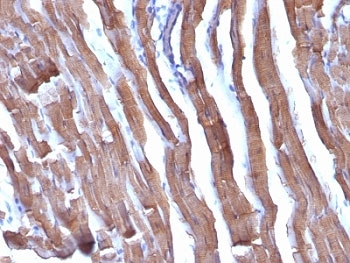 Muscle Actin Antibody - Formalin-fixed, paraffin-embedded rat heart stained with pan Muscle Actin antibody.  This image was taken for the unmodified form of this product. Other forms have not been tested.