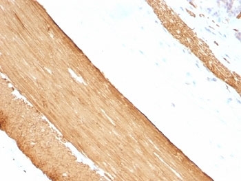 Muscle Actin Antibody - Formalin-fixed, paraffin-embedded rat stomach stained with pan Muscle Actin antibody.  This image was taken for the unmodified form of this product. Other forms have not been tested.