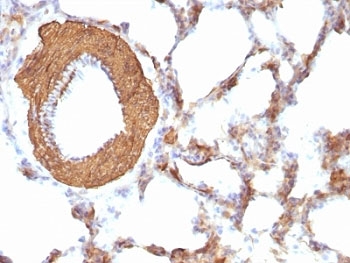 Muscle Actin Antibody - Formalin-fixed, paraffin-embedded rat lung stained with pan Muscle Actin antibody.  This image was taken for the unmodified form of this product. Other forms have not been tested.