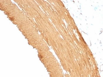 Muscle Actin Antibody - Formalin-fixed, paraffin-embedded rat stomach stained with pan Muscle Actin antibody.  This image was taken for the unmodified form of this product. Other forms have not been tested.