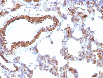 Muscle Actin Antibody - Formalin-fixed, paraffin-embedded rat lung stained with pan Muscle Actin antibody.  This image was taken for the unmodified form of this product. Other forms have not been tested.