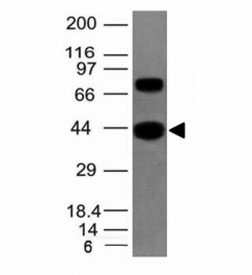 Muscle Actin Antibody - Western blot of human SKM tissue lysate using pan Muscle Actin antibody.  This image was taken for the unmodified form of this product. Other forms have not been tested.