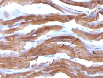 Muscle Actin Antibody - IHC testing of FFPE rat heart with Muscle Actin antibody (clone PMAC1-1).  This image was taken for the unmodified form of this product. Other forms have not been tested.