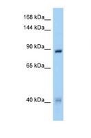 MUSK Antibody - MUSK antibody Western blot of HeLa Cell lysate. Antibody concentration 1 ug/ml.  This image was taken for the unconjugated form of this product. Other forms have not been tested.