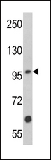 MUSK Antibody - Western blot of MUSK Antibody in Jurkat cell line lysates (35 ug/lane). MUSK (arrow) was detected using the purified antibody.